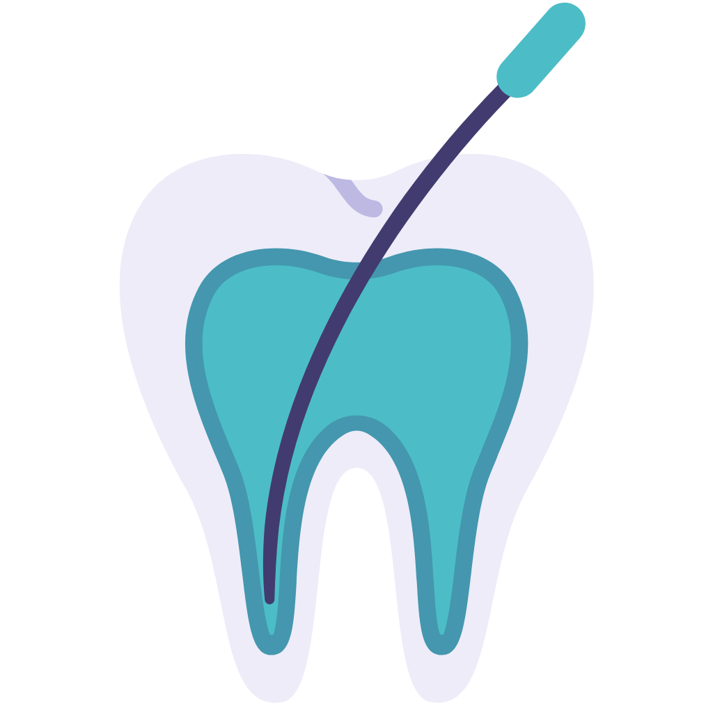 Root Canal Treatment