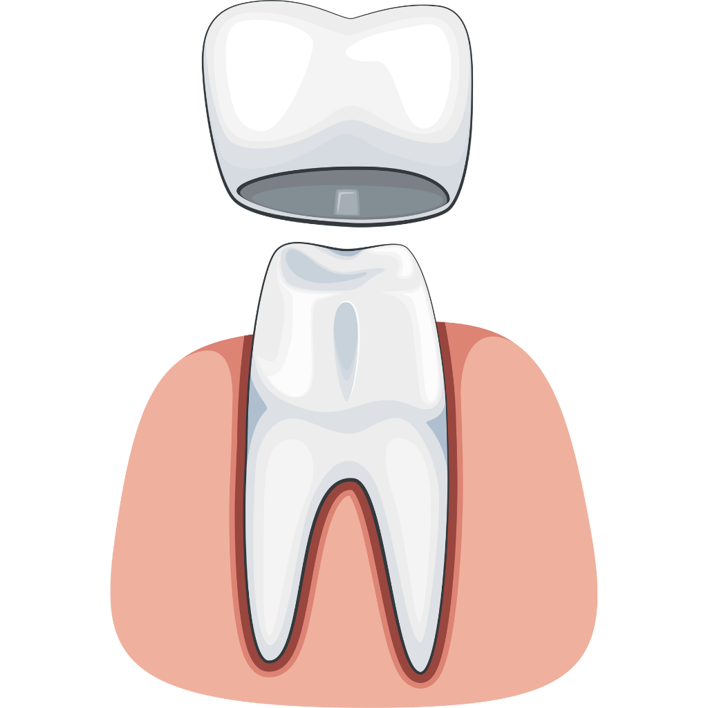 Tooth Crown