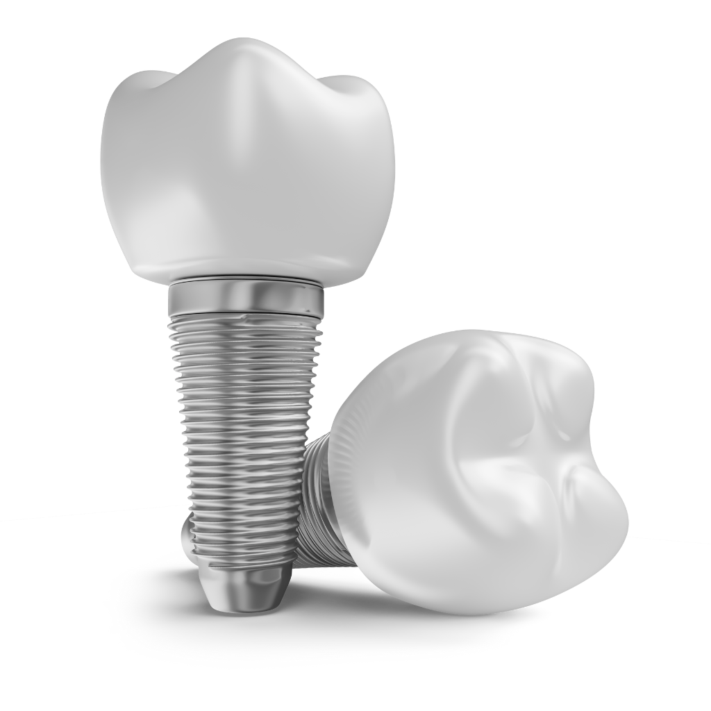 Dental Implants