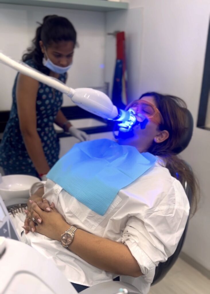 teeth-whitening-orca-dental-malad-east-mumbai